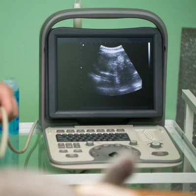 Veterinary ultrasound machine displaying a diagnostic scan during a pet imaging procedure.